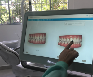 O escaneamento Invisalign em SP é realizado na Clínica A.R, que conta com toda a estrutura e equipamento disponível para este tipo de exame.