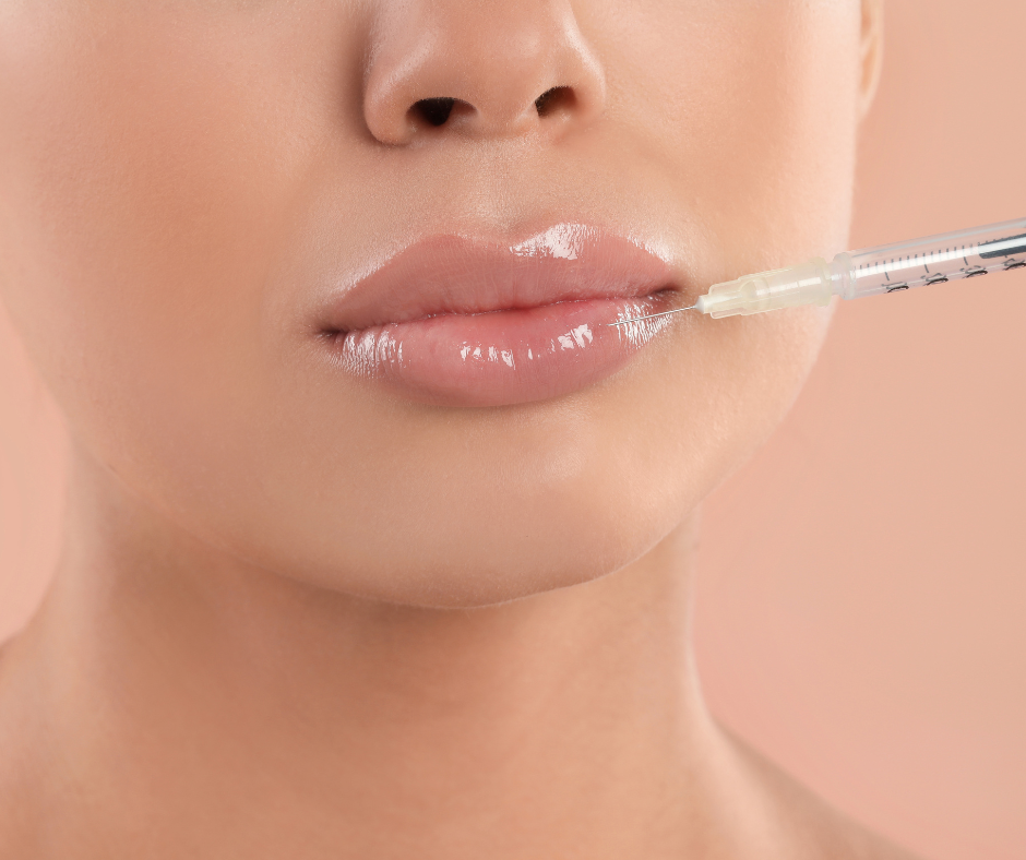 O preenchimento labial com ácido hialurônico oferece uma variedade de funções além do simples aumento de volume.
