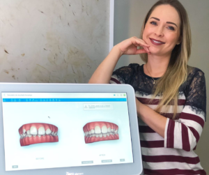 Parceria Invisalign com os maiores bancos: Santander, Bradesco, Itaú e Porto Seguro, é para você usuário dos cartões