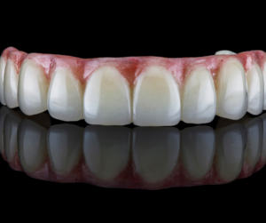 O dentista para prótese dentária na Casa Verde é o responsável pela realização do tratamento dos pacientes que estão sofrendo pela perda de um ou mais dentes.