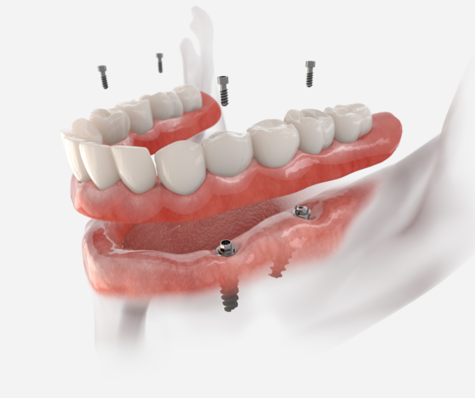 A Clínica AR é uma clínica especialista em prótese dentária em São Paulo. Com atendimento humanizado e tecnologia de ponta, todos os procedimentos são realizados com segurança, precisão e tranquilidade, por profissionais com grande expertise.