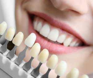 Buscando por dentista na Casa Verde especialista em estética dentária? Conheça a equipe de profissionais da A.R Odontologia & Harmonização. A A.R oferece consultas, exames e diferentes tipos de tratamentos dentários.