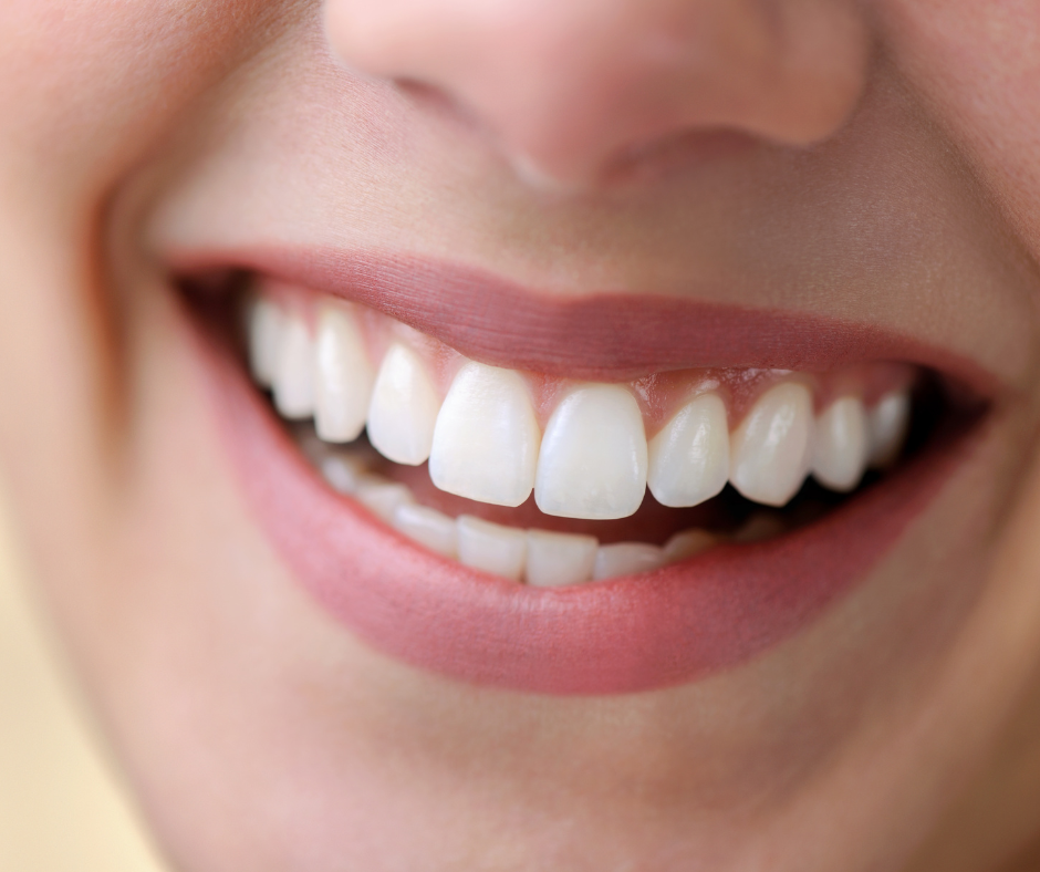 Além dos benefícios estéticos, um sorriso alinhado oferece uma série de vantagens para a saúde bucal e geral.