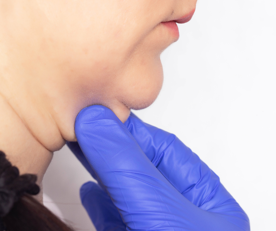 A platismoplastia é um procedimento cirúrgico que visa melhorar a aparência do pescoço, especialmente em casos de flacidez e excesso de pele.
