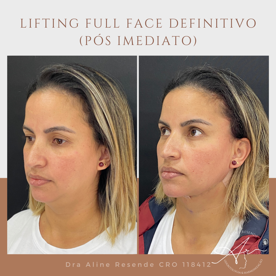 Eu sou a pessoa perfeita para ajudar nessa jornada maravilhosa. Descubra como despertar sua beleza com o Lifting Facial.