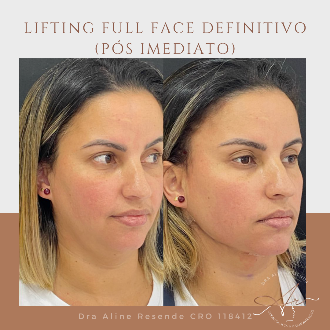 Eu sou a pessoa perfeita para ajudar nessa jornada maravilhosa. Descubra como despertar sua beleza com o Lifting Facial.