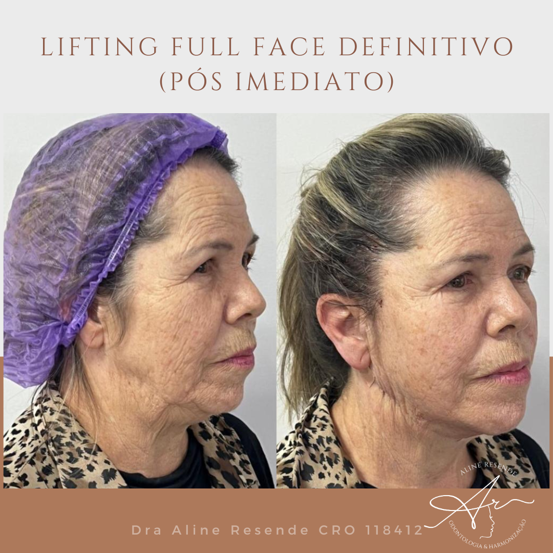 Eu sou a pessoa perfeita para ajudar nessa jornada maravilhosa. Descubra como despertar sua beleza com o Lifting Facial.