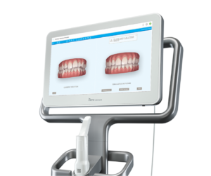 QOrtodontia: Dentes Alinhados, Sorriso Confiante