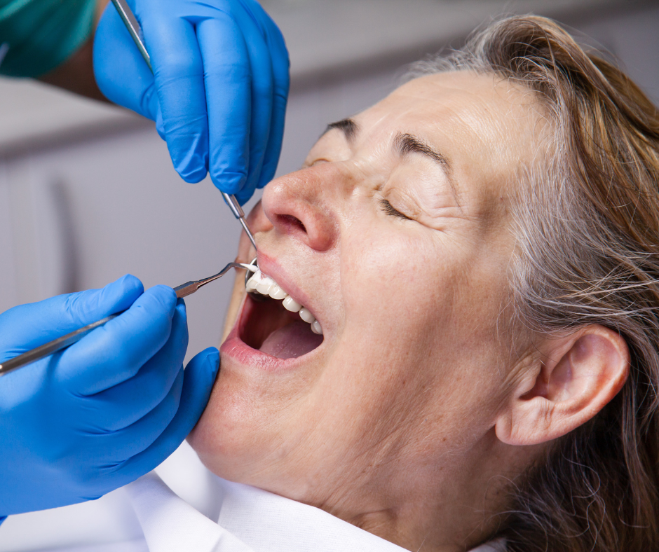 A extração dos dentes do siso é uma intervenção comum na odontologia. Aqui estão informações essenciais sobre a cirurgia.