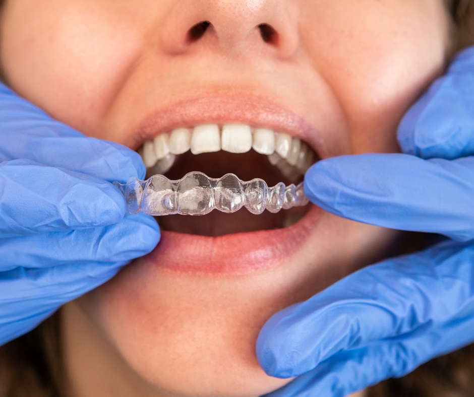 Quando se fala em cuidar dos dentes, a ortodontia é um dos primeiros tratamentos que vem à cabeça. Afinal, ter um sorriso alinhado vai muito além da estética.