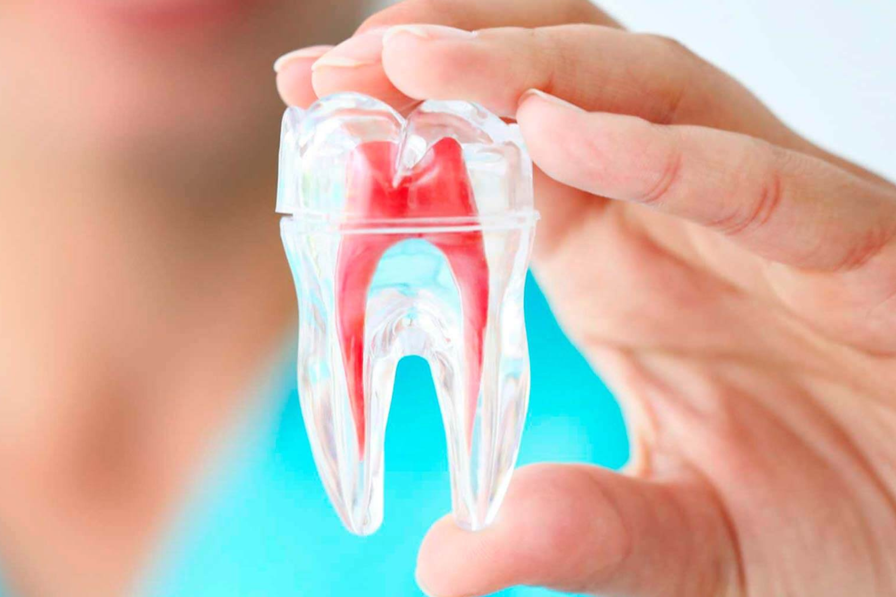 O que é o canal dentário? O canal dentário é uma estrutura fundamental na anatomia dos dentes, mas nem sempre é bem compreendido